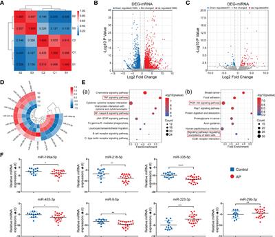 MiR-199a-5P promotes osteogenic differentiation of human stem cells from apical papilla via targeting IFIT2 in apical periodontitis